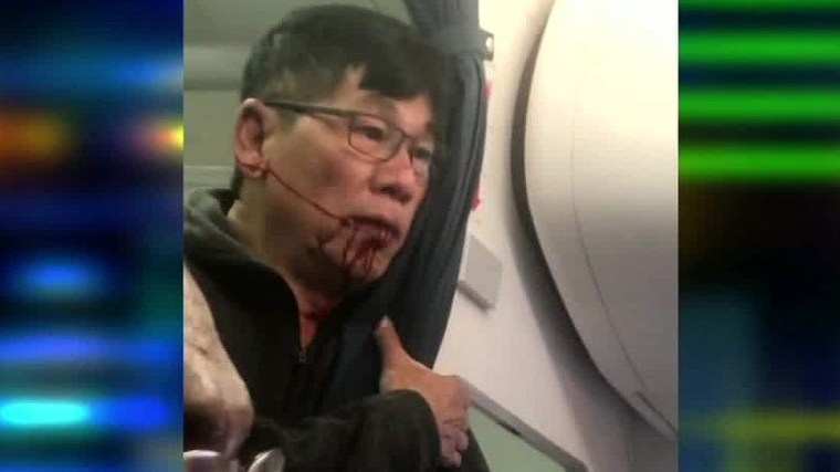 170410222008-united-flight-passenger-video-after-incident-john-klaassen-intv-ctn-00003430-super-169